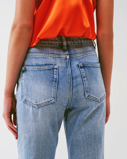 Sraight-Leg Jeans With Exposed Buttons And Ripped Knees